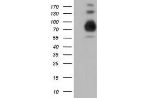 Western Blotting (WB) image for anti-phosphoinositide-3-Kinase Adaptor Protein 1 (PIK3AP1) antibody (ABIN1496827)