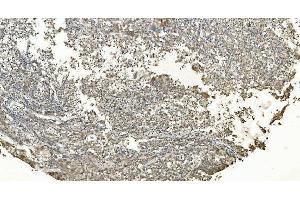 IHC analysis of FLCN using anti-FLCN antibody (ABIN7602491). (FLCN 抗体  (AA 8-551))
