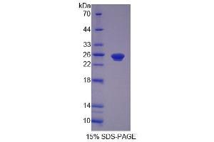 SDS-PAGE analysis of Human PEX1 Protein. (PEX1 蛋白)