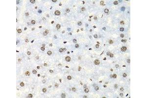 Immunohistochemistry of paraffin-embedded Mouse liver using IGF2BP2 Polyclonal Antibody at dilution of 1:100 (40x lens). (IGF2BP2 抗体)