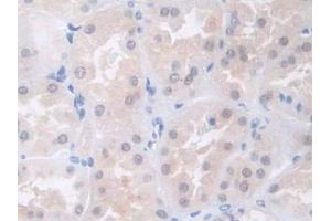 DAB staining on IHC-P; Samples: Human Kidney Tissue (COL4a5 抗体  (AA 1461-1685))