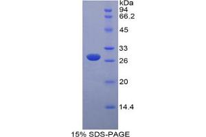 SDS-PAGE analysis of Mouse MYLK Protein. (MYLK 蛋白)