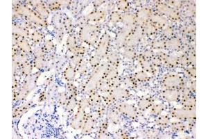 IHC testing of FFPE rat kidney with ADK antibody at 1ug/ml. (ADK 抗体)