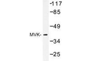 Western blot analysis of MVK antibody in extracts from COS-7 cell. (MVK 抗体)