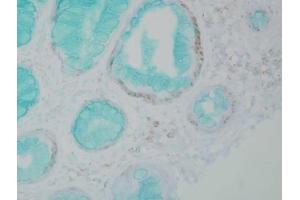 Immunohistochemistry analysis using Mouse Anti-DNMT1 Monoclonal Antibody, Clone 60B1220. (DNMT1 抗体  (AA 637-650))