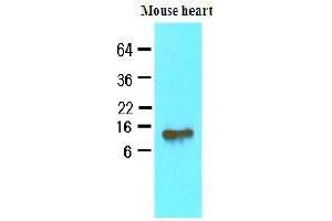 Western Blotting (WB) image for anti-Fatty Acid Binding Protein 4, Adipocyte (FABP4) (AA 1-132), (N-Term) antibody (ABIN336086) (FABP4 抗体  (N-Term))