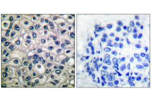 Immunohistochemistry (IHC) image for anti-Breast Cancer Anti-Estrogen Resistance 1 (BCAR1) (pTyr410) antibody (ABIN1847248) (BCAR1 抗体  (pTyr410))