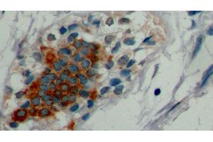 Immunohistochemistry (IHC) image for anti-Keratin 19 (KRT19) (AA 127-322) antibody (ABIN7426235)
