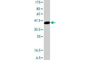 Western Blot detection against Immunogen (38. (SFMBT1 抗体  (AA 121-230))