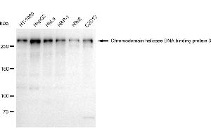 Western blotting analysis using Chromodomain helicase DNA binding protein 3 antibody (ABIN7798068). (Recombinant CHD3 抗体)