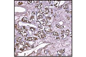 IHC analysis of FABP-1/GOT2 using anti-FABP-1/GOT2 antibody (ABIN7601426). (GOT2 抗体  (AA 35-430))