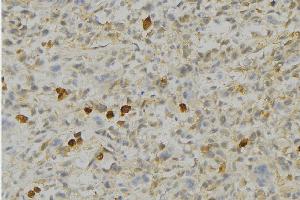 ABIN6276690 at 1/100 staining Human gastric tissue by IHC-P. (Peroxiredoxin 4 抗体  (C-Term))
