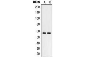 Western blot analysis of RHCG expression in NCIH460 (A), human testis (B) whole cell lysates. (RHCG 抗体  (Center))