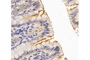 Immunohistochemistry (Paraffin-embedded Sections) (IHC (p)) image for anti-Solute Carrier Family 9 (Sodium/hydrogen Exchanger), Member 3 (SLC9A3) antibody (ABIN7075685)