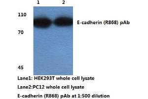Western blot analysis of E-cadherin (pArg868) (E-cadherin 抗体)