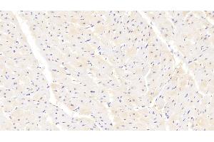 Detection of PPARg in Human Cardiac Muscle Tissue using Polyclonal Antibody to Peroxisome Proliferator Activated Receptor Gamma (PPARg) (PPARG 抗体  (AA 349-488))