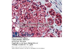 Immunohistochemistry (IHC) image for anti-Hepatocyte Growth Factor (Hepapoietin A, Scatter Factor) (HGF) (N-Term) antibody (ABIN2781816)