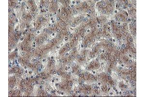 Image no. 7 for anti-Diphthamide Biosynthesis Protein 2 (DPH2) antibody (ABIN1497893)