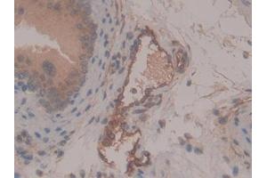DAB staining on IHC-P; Samples: Mouse Testis Tissue (CD13 抗体  (AA 720-961))