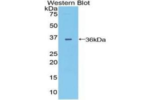 Detection of Recombinant DISP1, Mouse using Polyclonal Antibody to Dispatched Homolog 1 (DISP1) (DISP1 抗体  (AA 1141-1435))