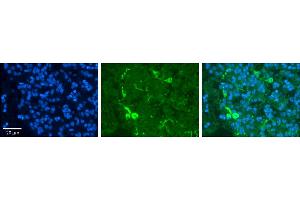 Rabbit Anti-PRDX2 Antibody     Formalin Fixed Paraffin Embedded Tissue: Human Pineal Tissue  Observed Staining: Cytoplasmic in cell bodies and processes of pinealocytes  Primary Antibody Concentration: 1:100  Other Working Concentrations: 1/600  Secondary Antibody: Donkey anti-Rabbit-Cy3  Secondary Antibody Concentration: 1:200  Magnification: 20X  Exposure Time: 0. (Peroxiredoxin 2 抗体  (Middle Region))
