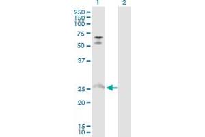 Western Blot analysis of MYO3A expression in transfected 293T cell line by MYO3A MaxPab polyclonal antibody. (MYO3A 抗体  (AA 1-247))