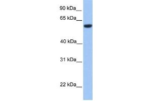 WB Suggested Anti-ZNF545 Antibody Titration: 0. (Zinc finger protein 82 homolog (ZFP82) (C-Term) 抗体)