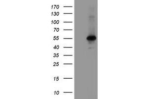 Image no. 1 for anti-Meis Homeobox 3 (MEIS3) (AA 1-261) antibody (ABIN1490668) (MEIS3 抗体  (AA 1-261))