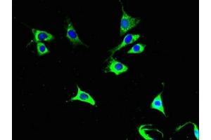 Immunofluorescent analysis of NIH/3T3 cells using ABIN7149175 at dilution of 1:100 and Alexa Fluor 488-congugated AffiniPure Goat Anti-Rabbit IgG(H+L) (COX6A1 抗体  (AA 25-109))