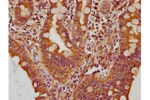 IHC image of ABIN7148519 diluted at 1:200 and staining in paraffin-embedded human small intestine tissue performed on a Leica BondTM system. (Copine III 抗体  (AA 297-442))