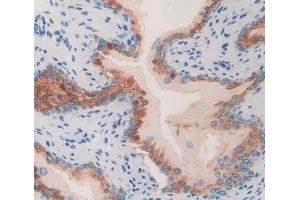 Used in DAB staining on fromalin fixed paraffin- embedded Kidney tissue (HAP1 抗体  (AA 132-328))