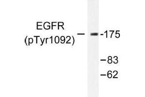 Image no. 1 for anti-Epidermal Growth Factor Receptor (EGFR) (pTyr1092) antibody (ABIN318011) (EGFR 抗体  (pTyr1092))