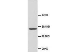 Western blot analysis of rat brain tissue lysis using ABI-1 antibody (ABI1 抗体  (C-Term))