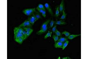 Immunofluorescent analysis of Hela cells using ABIN7172340 at dilution of 1:100 and Alexa Fluor 488-congugated AffiniPure Goat Anti-Rabbit IgG(H+L) (TNIK 抗体  (AA 523-714))