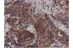 Immunohistochemical staining of paraffin-embedded Human Kidney tissue using anti-PRKD2 mouse monoclonal antibody. (PKD2 抗体)