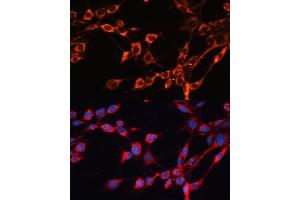 Immunofluorescence analysis of NIH/3T3 cells using SLC25 antibody (ABIN6132661, ABIN6147921, ABIN6147922 and ABIN6215721) at dilution of 1:100. (SLC25A24 抗体  (AA 1-200))
