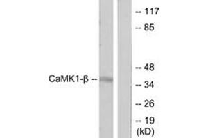Western blot analysis of extracts from LOVO cells, treated with H2O2 100uM 30', using CaMK1-beta Antibody. (PNCK 抗体  (AA 161-210))