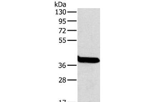 Western Blot analysis of Mouse liver tissue using OTC Polyclonal Antibody at dilution of 1:800 (OTC 抗体)