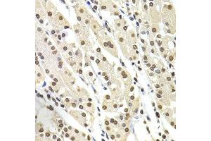 Immunohistochemistry of paraffin-embedded human stomach using SOX5 antibody at dilution of 1:100 (x400 lens). (SOX5 抗体)