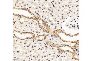 Immunohistochemistry of paraffin embedded rat kidney using EP0 (ABIN7073860) at dilution of 1: 900 (400x lens) (EPO 抗体)