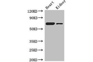 Western Blot Positive WB detected in: Mouse heart tissue, Mouse kidney tissue All lanes: ETFDH antibody at 3 μg/mL Secondary Goat polyclonal to rabbit IgG at 1/50000 dilution Predicted band size: 69, 63 kDa Observed band size: 69 kDa (ETFDH 抗体  (AA 34-617))
