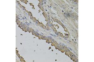 Immunohistochemistry of paraffin-embedded human prostate using FMR1NB antibody (ABIN1876396) at dilution of 1:100 (40x lens). (FMR1NB 抗体)