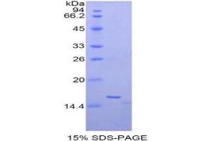 SDS-PAGE analysis of Human Matrix Gla Protein. (MGP 蛋白)