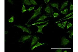 Immunofluorescence of monoclonal antibody to OCLN on HeLa cell. (Occludin 抗体  (AA 423-522))