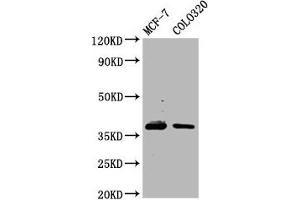 Western Blot Positive WB detected in: MCF-7 whole cell lysate, Colo320 whole cell lysate All lanes: PGLYRP3 antibody at 4. (PGLYRP3 抗体  (AA 90-222))
