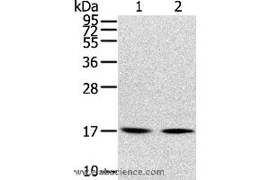 Western blot analysis of Human normal liver tissue and hepg2 cell, using RPLP1 Polyclonal Antibody at dilution of 1:400 (RPLP1 抗体)