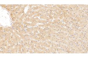 Immunohistochemistry (IHC) image for anti-serpin Peptidase Inhibitor, Clade A (Alpha-1 Antiproteinase, Antitrypsin), Member 10 (SERPINA10) (AA 24-444) antibody (ABIN7426439)
