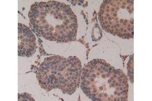 Immunohistochemistry (IHC) image for anti-ATPase, H+ Transporting, Lysosomal Accessory Protein 2 (ATP6AP2) (AA 18-302) antibody (ABIN1862221)