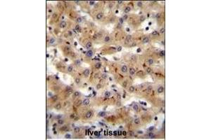 CSAD Antibody (Center) (ABIN655728 and ABIN2845175) immunohistochemistry analysis in formalin fixed and paraffin embedded human liver tissue followed by peroxidase conjugation of the secondary antibody and DAB staining. (CSAD 抗体  (AA 197-226))
