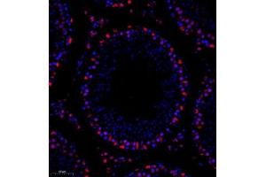 Immunofluorescence (Paraffin-embedded Sections) (IF (p)) image for anti-TBC1 (Tre-2/USP6, BUB2, Cdc16) Domain Family, Member 1 (TBC1D1) antibody (ABIN7075843)